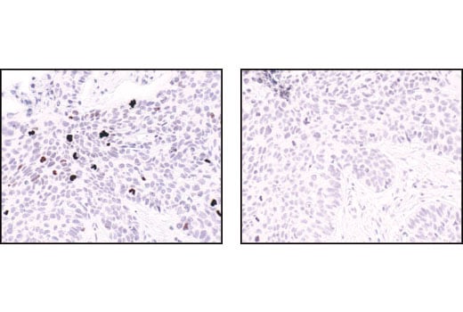 Immunohistochemistry Image 6: Phospho-Histone H3 (Ser10) Antibody