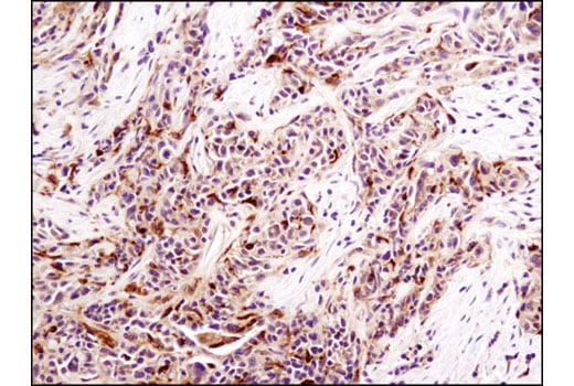 Immunohistochemistry Image 2: LKB1 (D60C5F10) Rabbit Monoclonal Antibody (IHC Formulated)