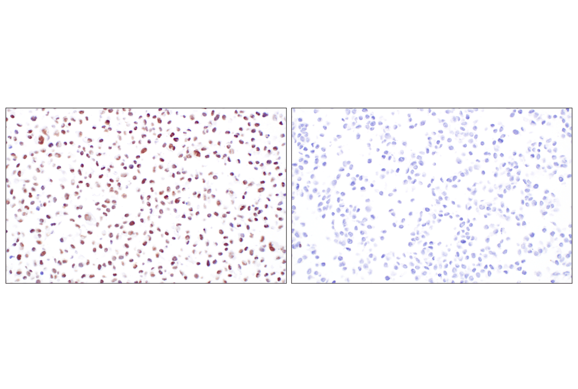 Immunohistochemistry Image 10: HDAC2 (3F3) Mouse Monoclonal Antibody