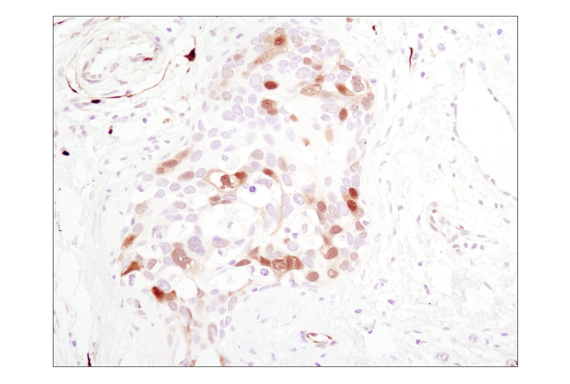 Phospho-Erk1/2 Pathway Antibody Sampler Kit | Cell Signaling