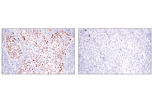 Immunohistochemistry Image 2: p14 ARF (E3X6D) Rabbit mAb (BSA and Azide Free)