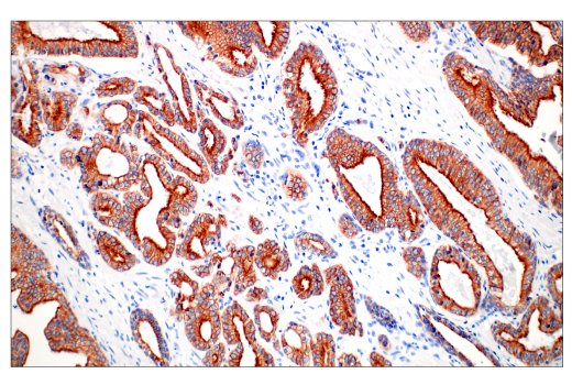 Immunohistochemistry Image 2: Pan-Keratin (C11) Mouse Monoclonal Antibody (BSA and Azide Free)
