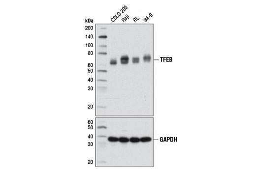 Western Blotting Image 2: TFEB Antibody