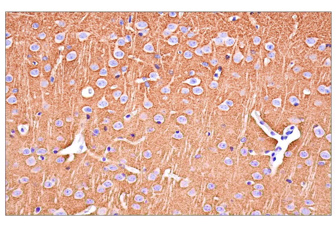 Immunohistochemistry Image 2: VGLUT1 (E8L5B) Rabbit Monoclonal Antibody
