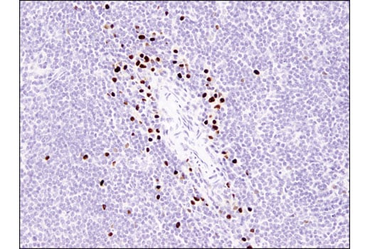 Immunohistochemistry Image 4: MIST1/bHLHa15 (D7N4B) Rabbit Monoclonal Antibody