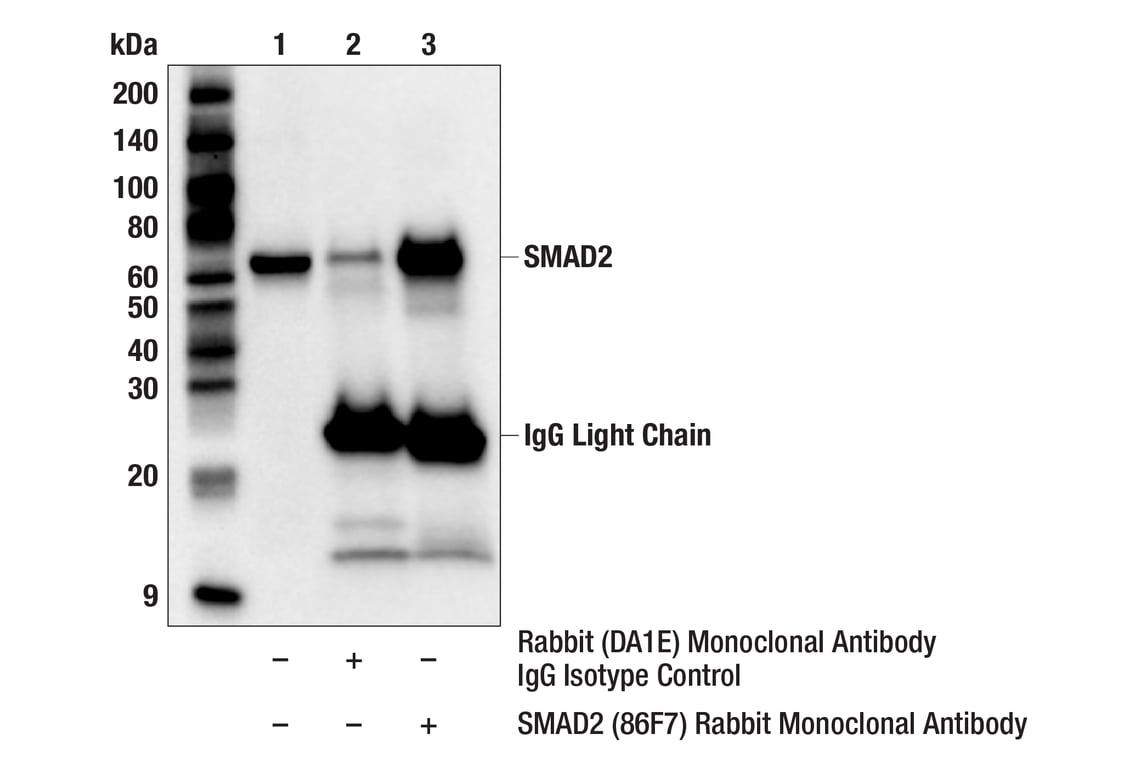 Immunoprecipitation Image 1: SMAD2 (86F7) Rabbit Monoclonal Antibody