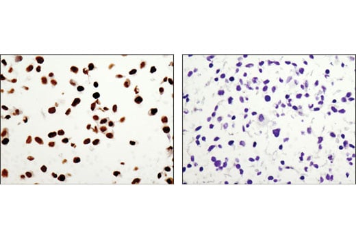 Immunohistochemistry Image 2: DAX1 (D2F1) Rabbit Monoclonal Antibody