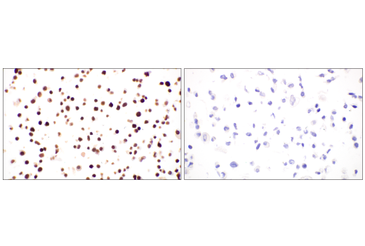 Immunohistochemistry Image 5: Thyroid Transcription Factor 1 (TTF-1) (SPT24) Mouse Monoclonal Antibody