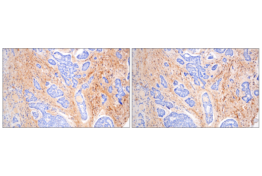 Immunohistochemistry Image 5: Fibronectin/FN1 (E5H6X) Rabbit Monoclonal Antibody (BSA and Azide Free)