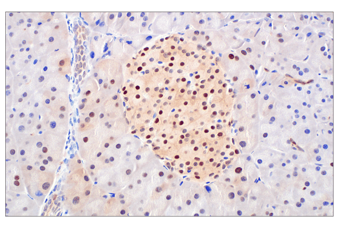 Immunohistochemistry Image 1: CDK4 (F8L5F) Rabbit Monoclonal Antibody