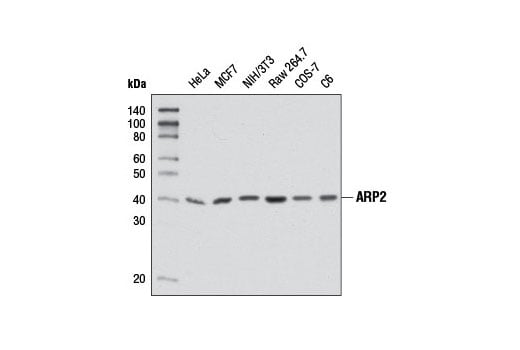 Western Blotting Image 1: ARP2 (D85D5) Rabbit mAb