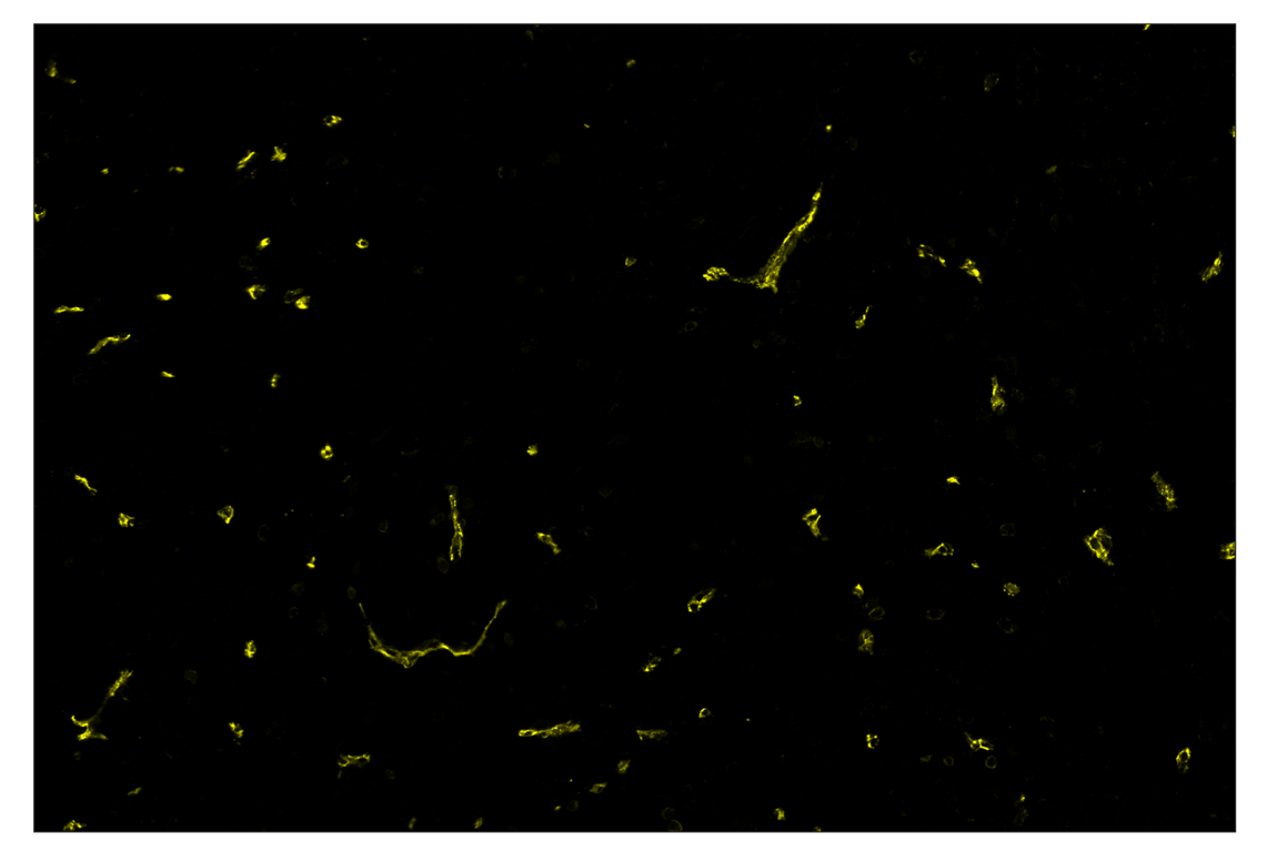 Immunohistochemistry Image 3: CD31 (PECAM-1) (D8V9E) & CO-0050-594 SignalStar<sup>™</sup> Oligo-Antibody Pair