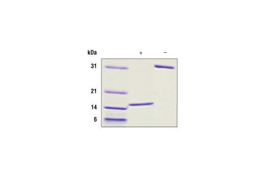 undefined Image 2: Human GDNF Recombinant Protein