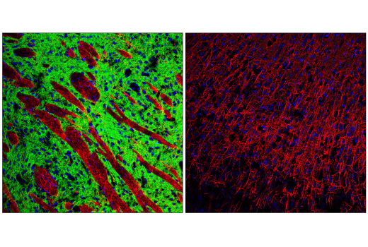 Immunofluorescence Image 1: Dopamine D(1) Receptor/D1R (E3H3S) Rabbit Monoclonal Antibody