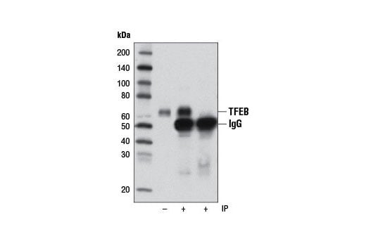 Immunoprecipitation Image 1: TFEB Antibody