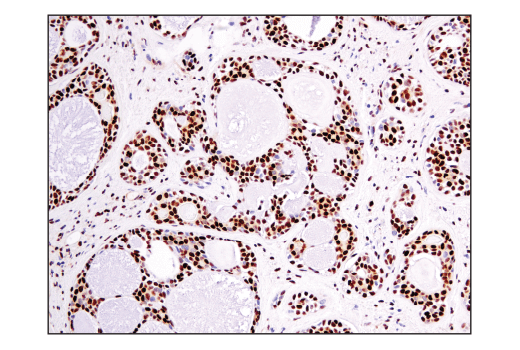 Immunohistochemistry Image 8: Ape1 (E5Y2C) Rabbit Monoclonal Antibody