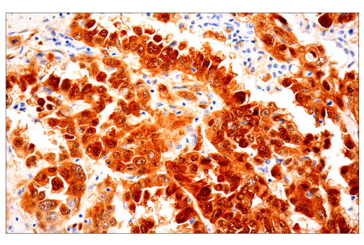Immunohistochemistry Image 2: YAP/TAZ (E9M8G) Rabbit Monoclonal Antibody (BSA and Azide Free)