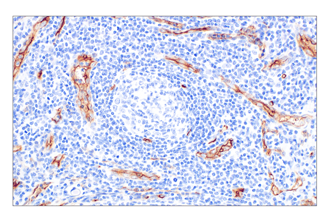 Immunohistochemistry Image 4: CD34 (QBEND/10) Mouse Monoclonal Antibody