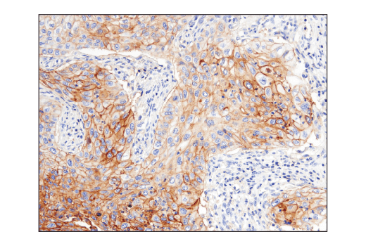 Immunohistochemistry Image 3: CD47 (D3O7P) Rabbit Monoclonal Antibody
