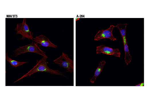 Immunofluorescence Image 1: Vti1a (D8U3M) Rabbit Monoclonal Antibody