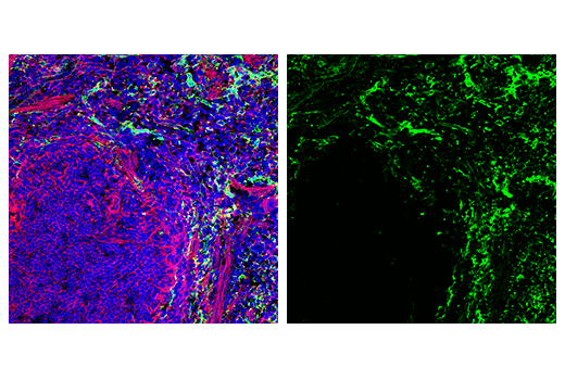 Immunofluorescence Image 2: CD206/MRC1 (E6T5J) Rabbit Monoclonal Antibody