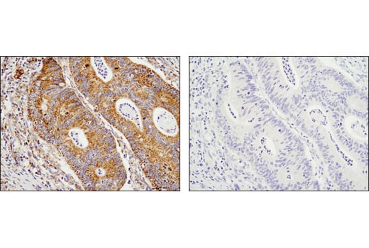 Immunohistochemistry Image 1: SDHA (D6J9M) Rabbit Monoclonal Antibody