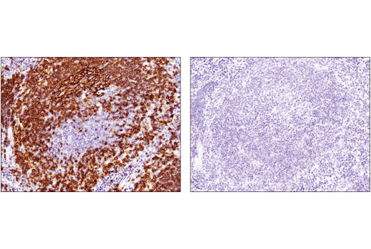 Immunohistochemistry Image 5: Fc-gamma RIIB (D8F9C) Rabbit Monoclonal Antibody