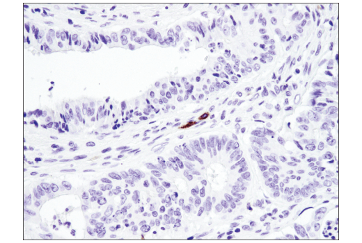 Immunohistochemistry Image 4: TNFRSF8/CD30 (E4L4I) Rabbit Monoclonal Antibody