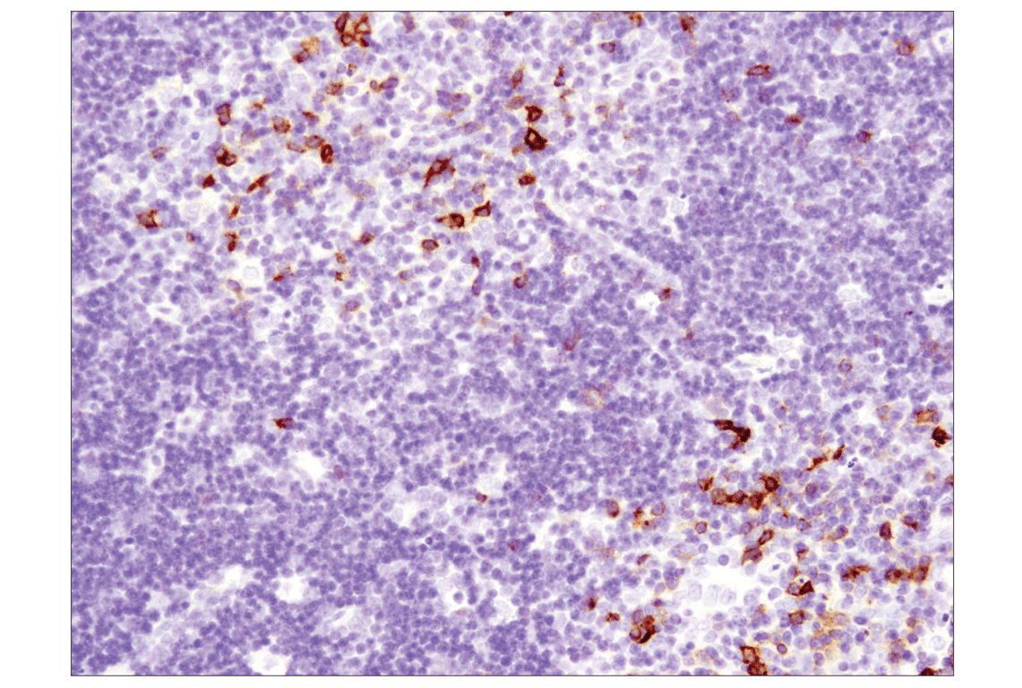 Immunohistochemistry Image 7: OX40 (E9U7O) Rabbit Monoclonal Antibody (BSA and Azide Free)