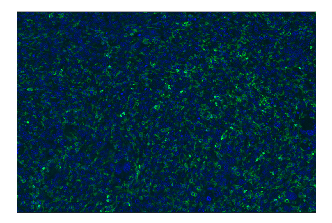 Immunohistochemistry Image 2: CD11b/ITGAM (E4K8C) Rabbit Monoclonal Antibody (Alexa Fluor<sup>®</sup> 488 Conjugate)