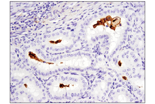 Immunohistochemistry Image 3: GPNMB (E4D7P) Rabbit Monoclonal Antibody