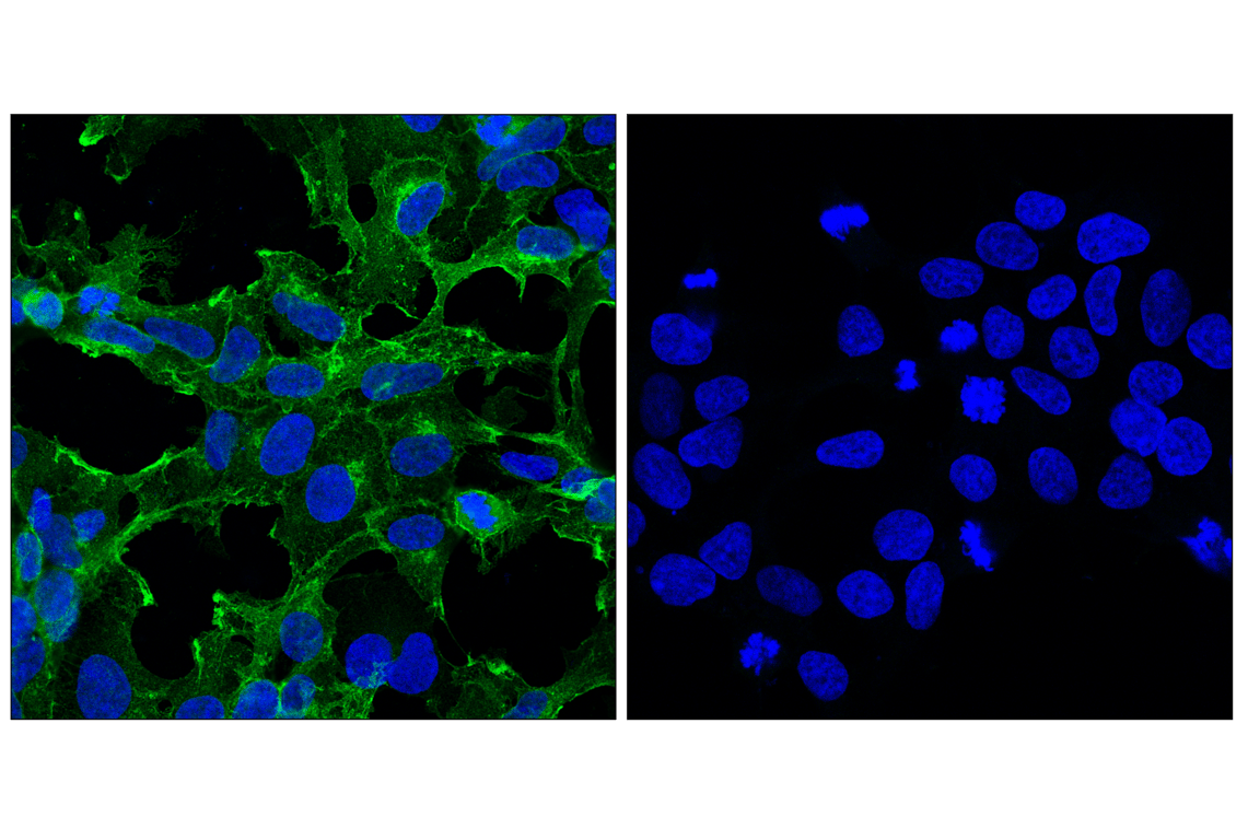 Immunofluorescence Image 1: Myc-Tag (E7F9B) Mouse Monoclonal Antibody