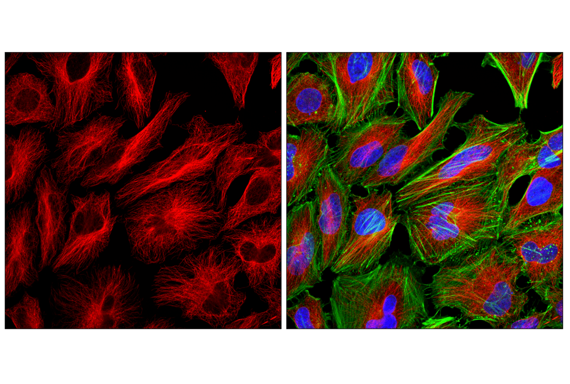 Immunofluorescence Image 1: Goat Anti-Mouse IgG (H+L) Antibody (Alexa Fluor<sup>®</sup> 568 Conjugate)