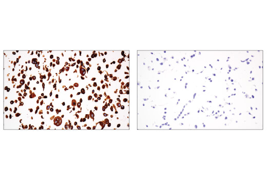 Immunohistochemistry Image 1: MLANA/MART-1 (E9Q4O) Rabbit Monoclonal Antibody