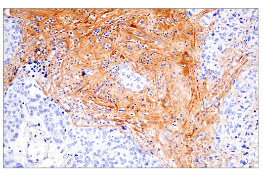 Immunohistochemistry Image 6: Fibronectin/FN1 (E5H6X) Rabbit Monoclonal Antibody (BSA and Azide Free)