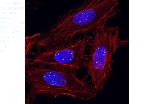 Coilin (D2L3J) XP® Rabbit mAb | Cell Signaling Technology
