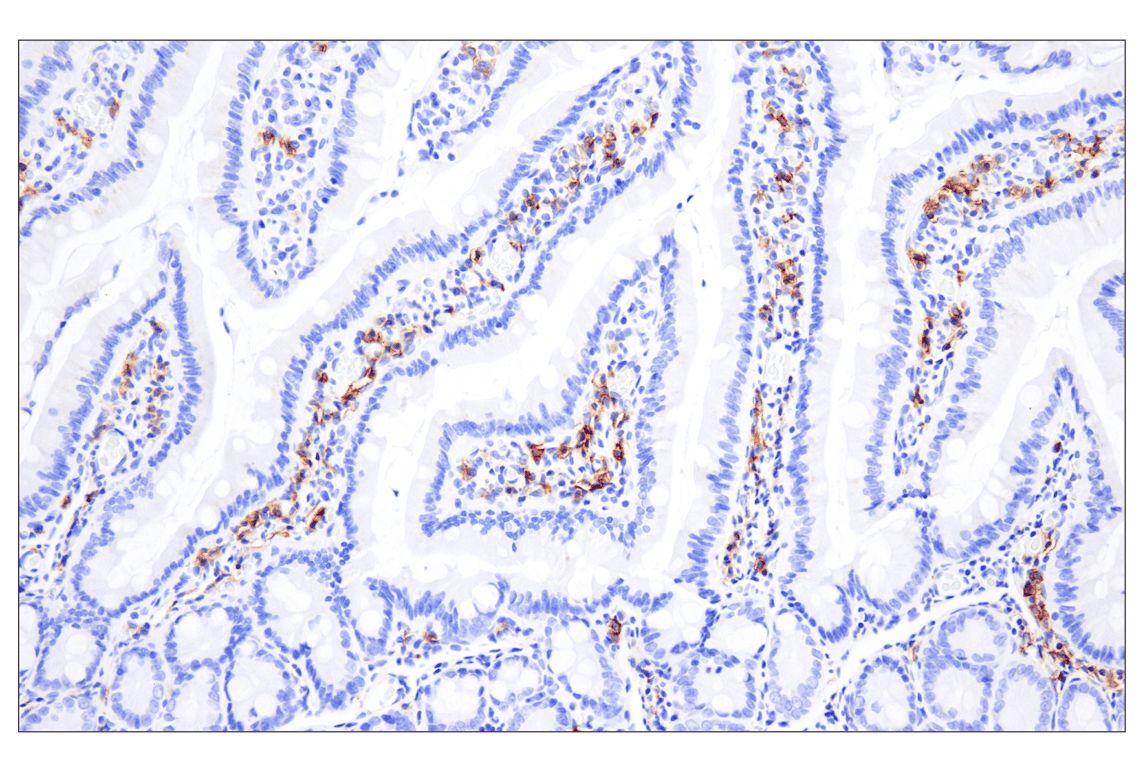 Immunohistochemistry Image 4: CD20 (E3N7O) Rabbit Monoclonal Antibody