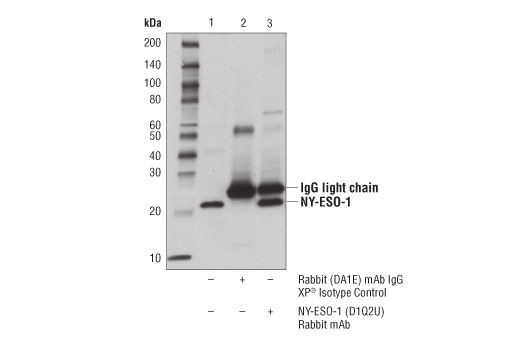 Immunoprecipitation Image 1: NY-ESO-1 (D1Q2U) Rabbit Monoclonal Antibody