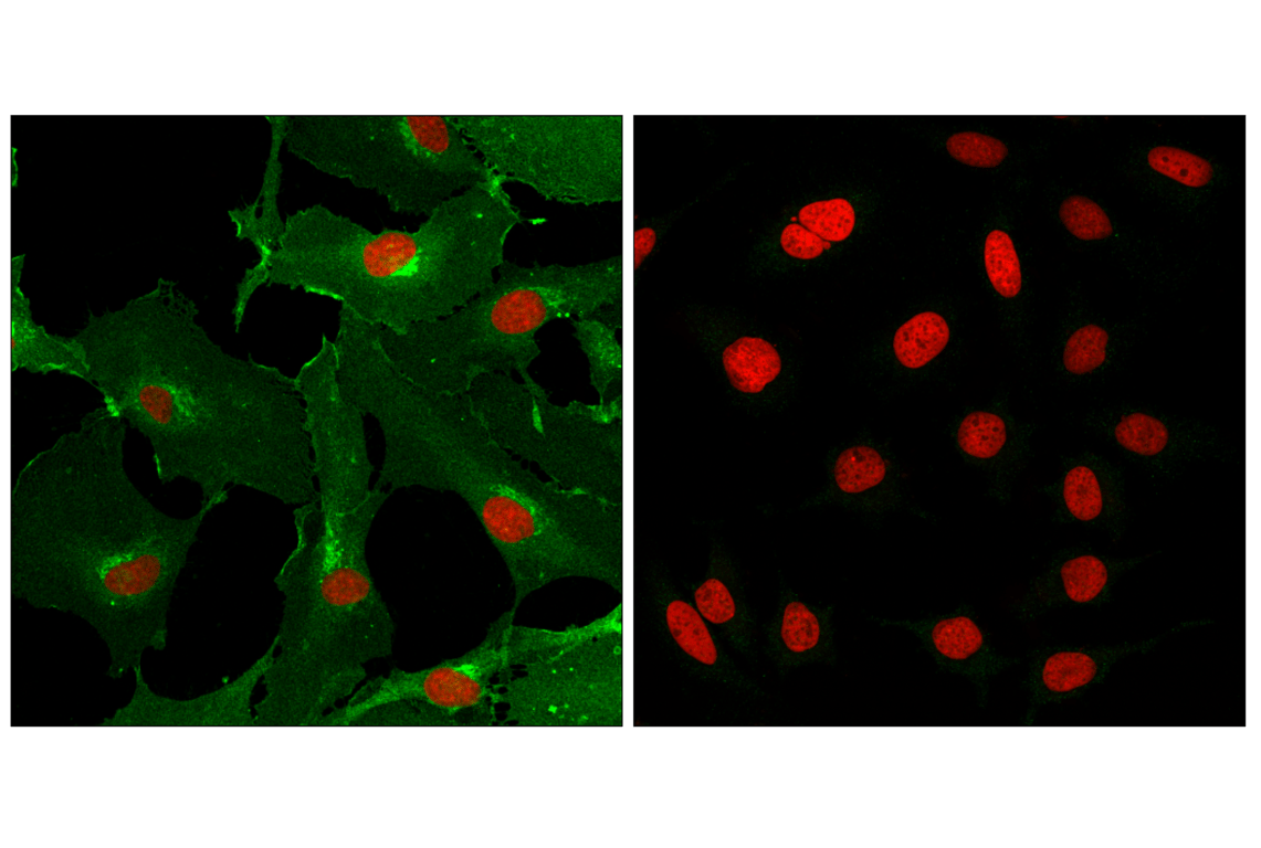 Immunofluorescence Image 1: eNOS (D9A5L) Rabbit Monoclonal Antibody