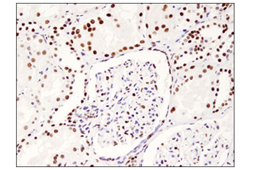 Immunohistochemistry Image 2: PELP1 (D5Q4W) Rabbit Monoclonal Antibody (BSA and Azide Free)