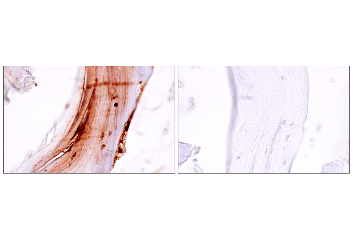 Immunohistochemistry Image 5: Osteocalcin (E8B9X) Rabbit Monoclonal Antibody
