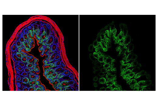 Immunofluorescence Image 2: AQP4 (D1F8E) Rabbit Monoclonal Antibody (Alexa Fluor<sup>®</sup> 488 Conjugate)