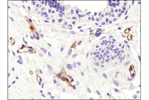 Immunohistochemistry Image 1: HGF beta (D6S7D) Rabbit Monoclonal Antibody