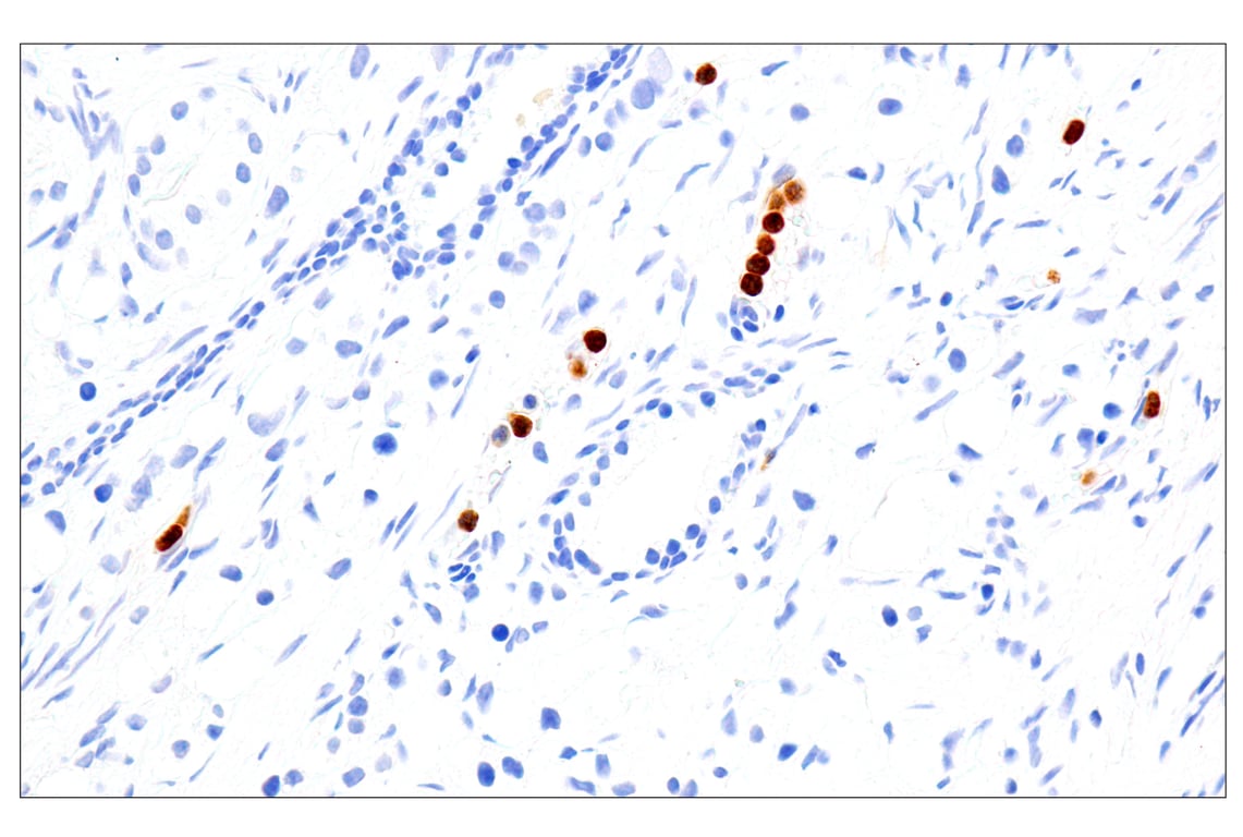 Immunohistochemistry Image 5: Eosinophil cationic protein (E6U5M) Rabbit Monoclonal Antibody
