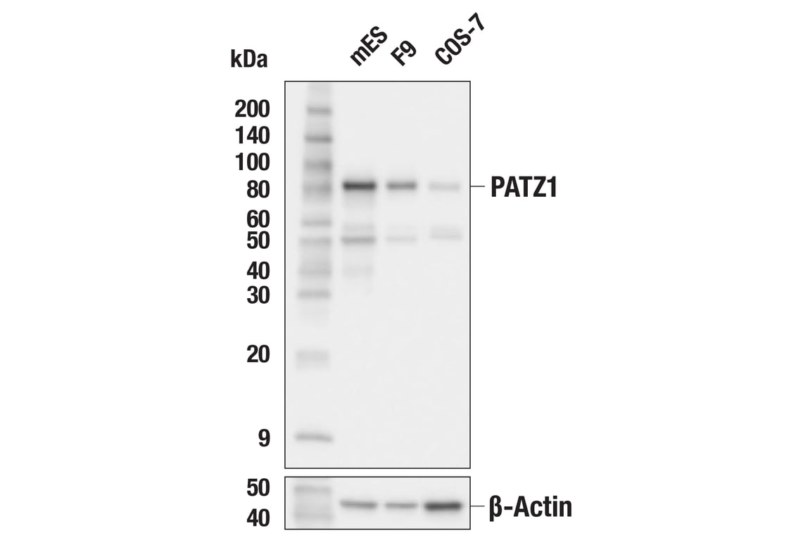 Western Blotting Image 2: PATZ1 (F2N4R) Rabbit Monoclonal Antibody