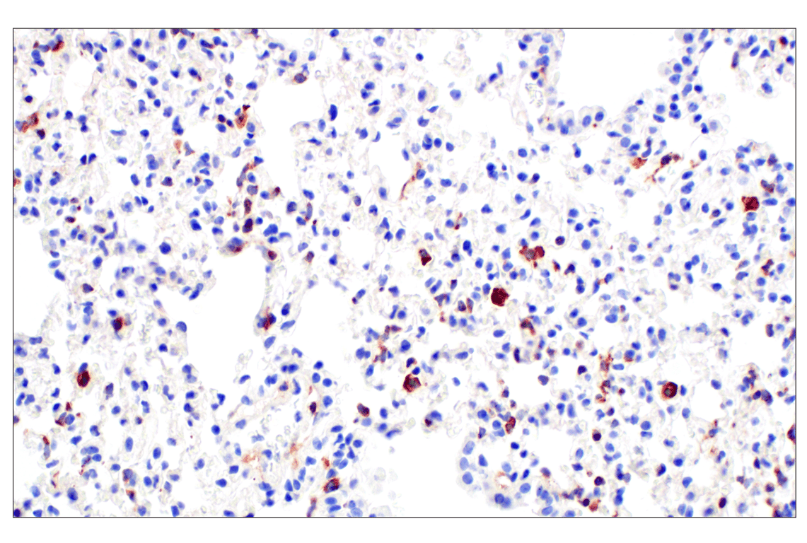 Immunohistochemistry Image 5: TRAF5 (F6W4N) Rabbit Monoclonal Antibody