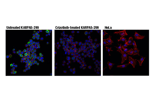 Immunofluorescence Image 1: Phospho-ALK (Tyr1507) (D6F1V) Rabbit Monoclonal Antibody