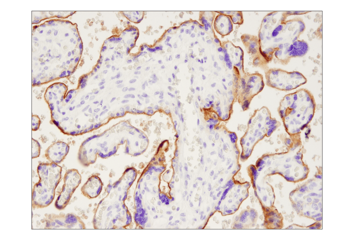 Immunohistochemistry Image 2: PD-L1 (Extracellular Domain Specific) (E1J2J<sup>™</sup>) Rabbit Monoclonal Antibody (BSA and Azide Free)