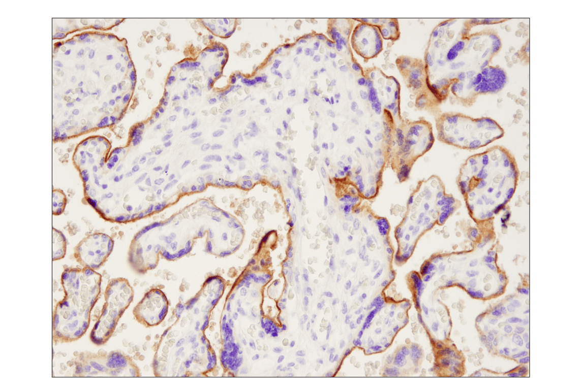 Immunohistochemistry Image 2: PD-L1 (Extracellular Domain Specific) (E1J2J<sup>™</sup>) Rabbit mAb (BSA and Azide Free)