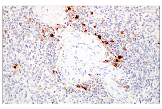 Immunohistochemistry Image 8: LAMP3/CD208 (E6E5U) Rabbit Monoclonal Antibody